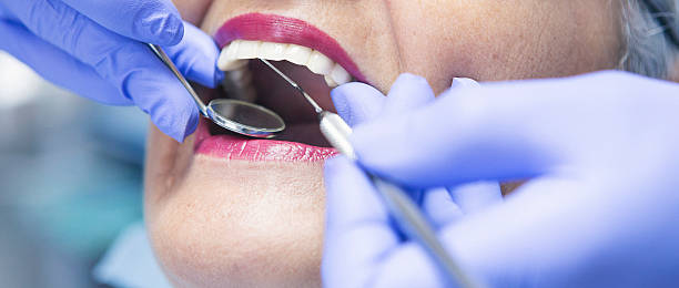 Best Emergency Dental Care for Broken or Chipped Teeth in Sawgrass, FL